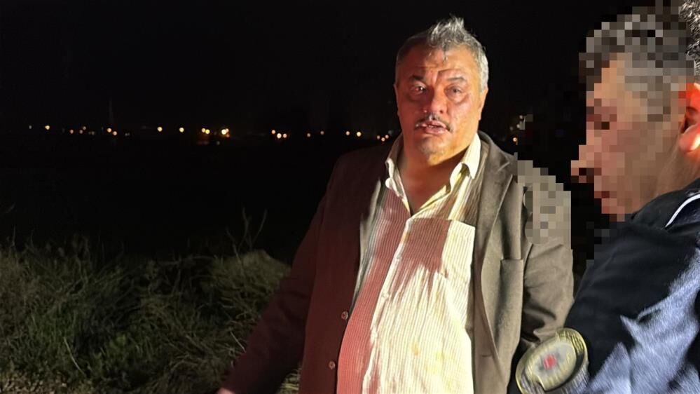 Polisten Kacan Alkollu Surucu Polis Aracinda Binecegi Yeri Begenmedi (2)