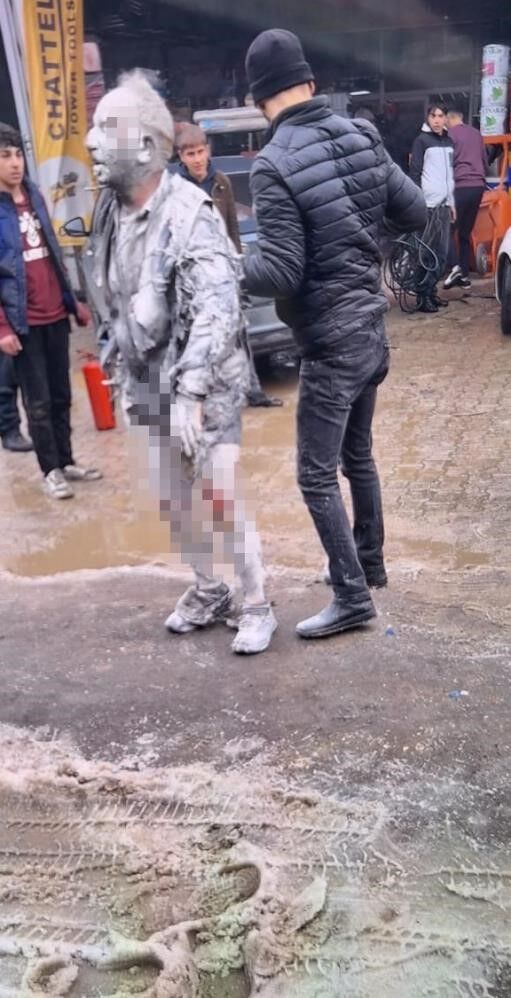 Sanayi Sitesinde Patlama Olmustu 77 Yasindaki Hasan Yuntem 4 Aylik Mucadelenin Ardinda (3)