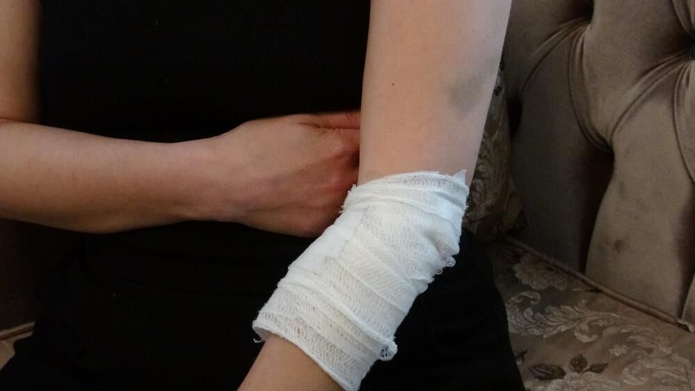 Cocugunun Gozu Onunde Dehset Genc Kadini 6 Yerinden Bicakladi (2)