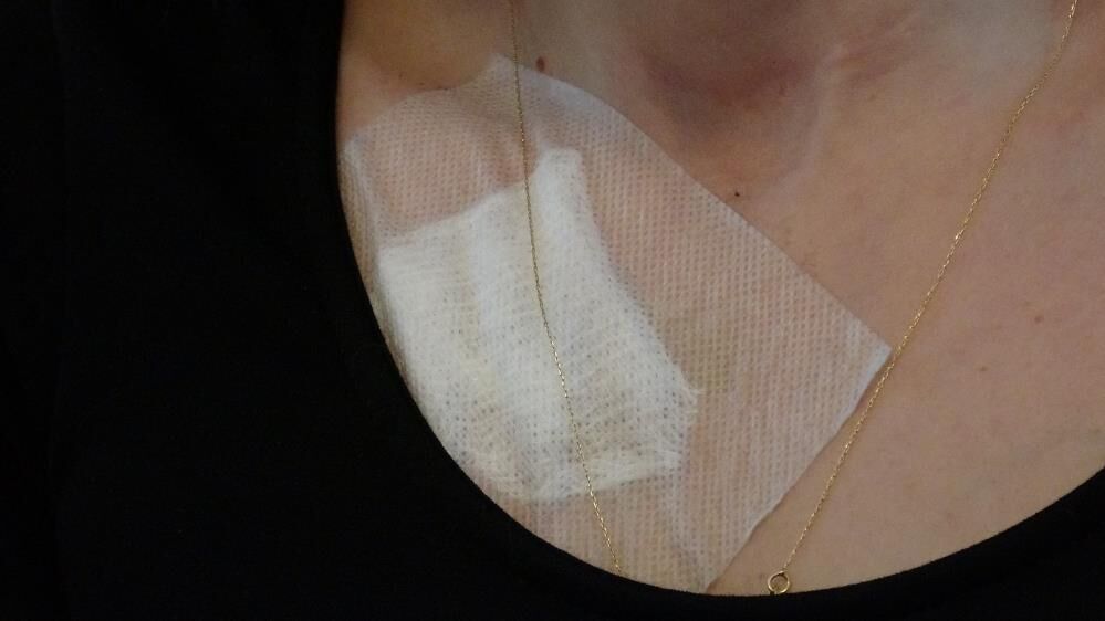 Cocugunun Gozu Onunde Dehset Genc Kadini 6 Yerinden Bicakladi (3)
