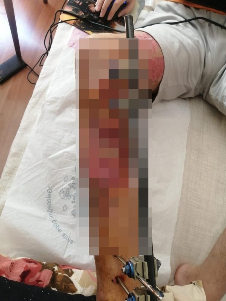 Kamera Goruntuleri Ortaya Cikti Uyuyan Soforun Kazasi Bir Gencin Hayatini Karartti (6)
