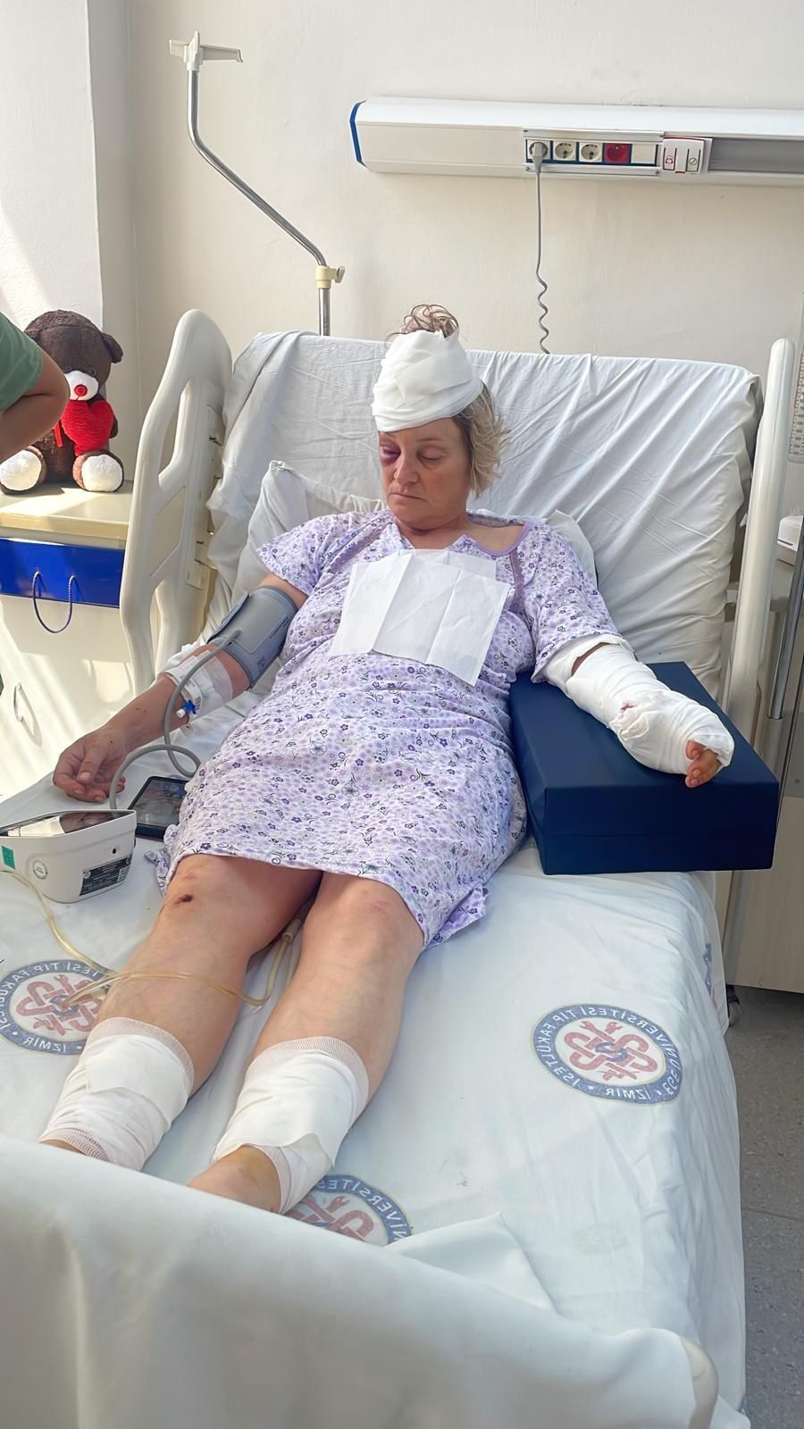 Kopek Saldirisinda Paramparca Oldu 80 Dikis Kopan Deri Tutulmayan Sozler (4)