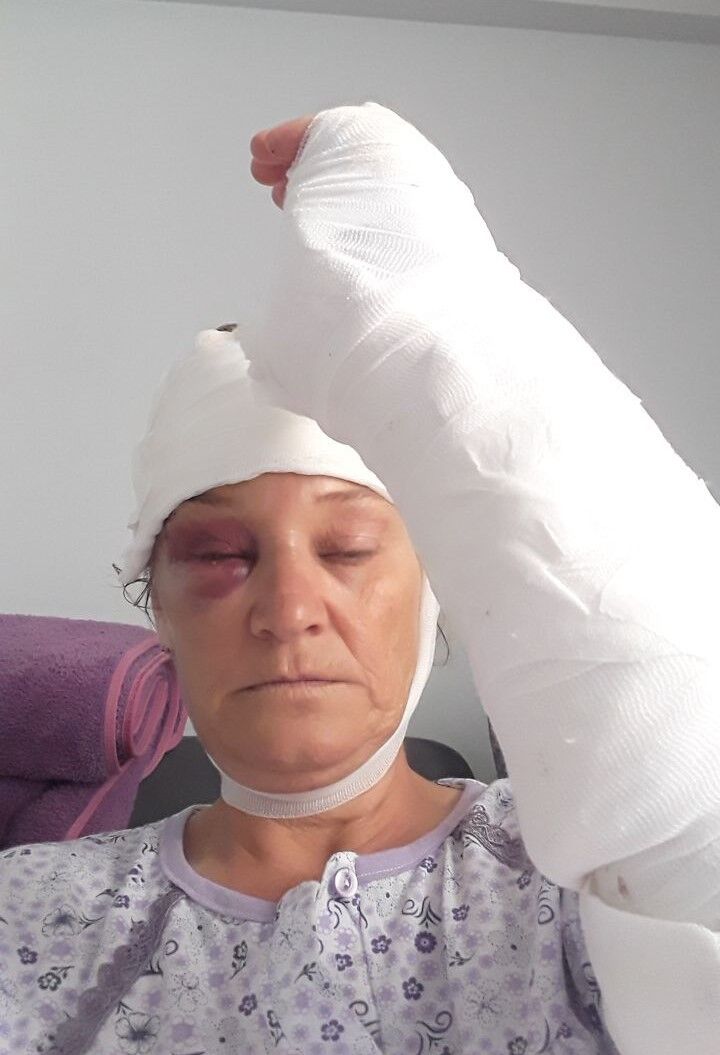 Kopek Saldirisinda Paramparca Oldu 80 Dikis Kopan Deri Tutulmayan Sozler (7)