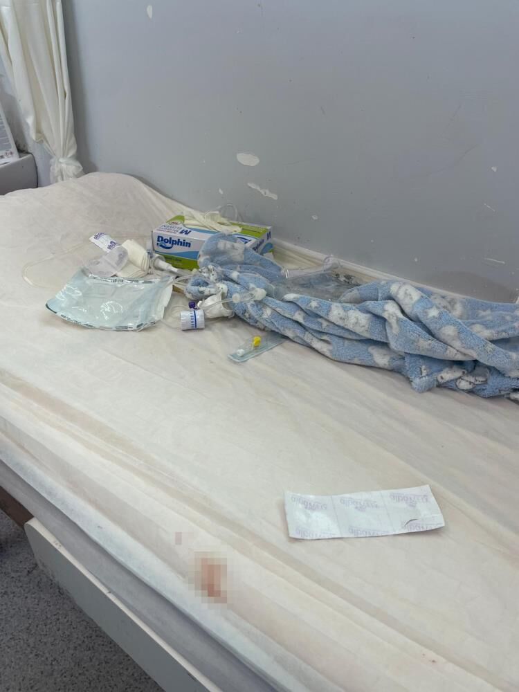 Devlet Hastanesinde Korkunc Ihmal Hemsire 5 Aylik Bebegin Parmagini Kesti (5)