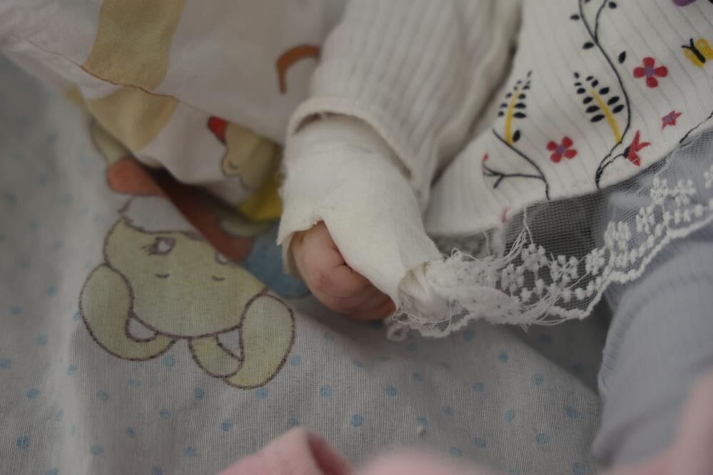 Devlet Hastanesinde Korkunc Ihmal Hemsire 5 Aylik Bebegin Parmagini Kesti (8)