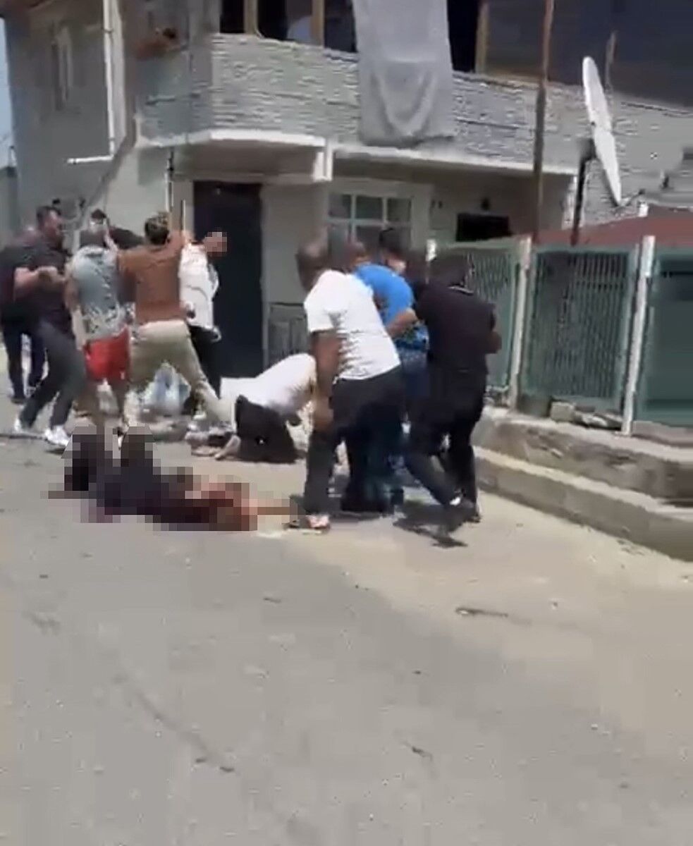 Kan Donduran Ifade 5 Cocuk Annesini 15 Yerinden Bicakladi Cocugumla Bakisinca Vazgecti (3)