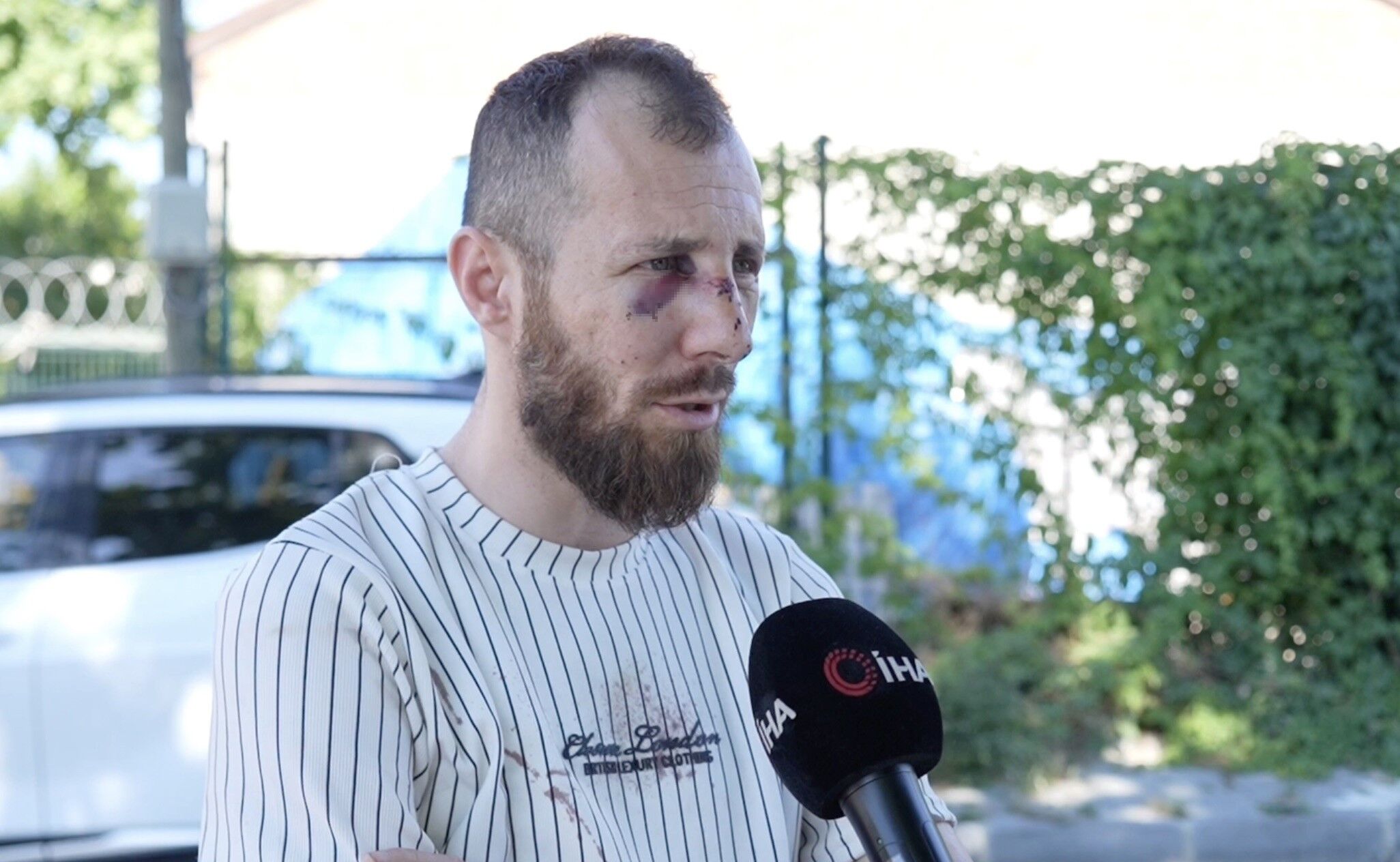 Pide Satisi Srasinda Darp Edildi O Anlar Canli Yayinda (3)