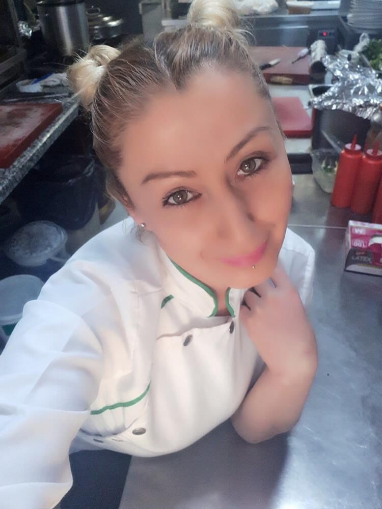 Gulusum Yok Yemek Yemek Problem Estetik Sonrasi Hayati Degisti (2)