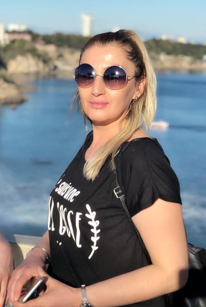Gulusum Yok Yemek Yemek Problem Estetik Sonrasi Hayati Degisti (3)