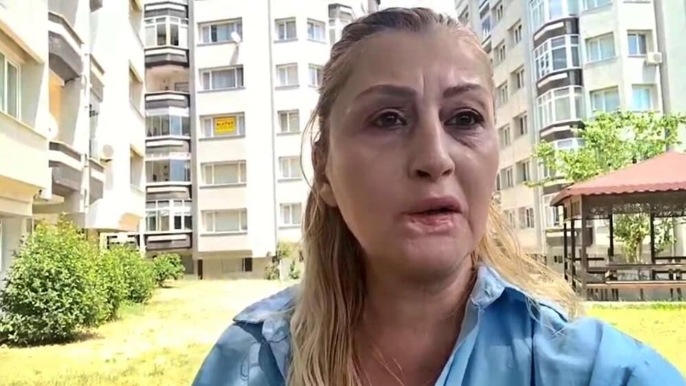 Gulusum Yok Yemek Yemek Problem Estetik Sonrasi Hayati Degisti (5)