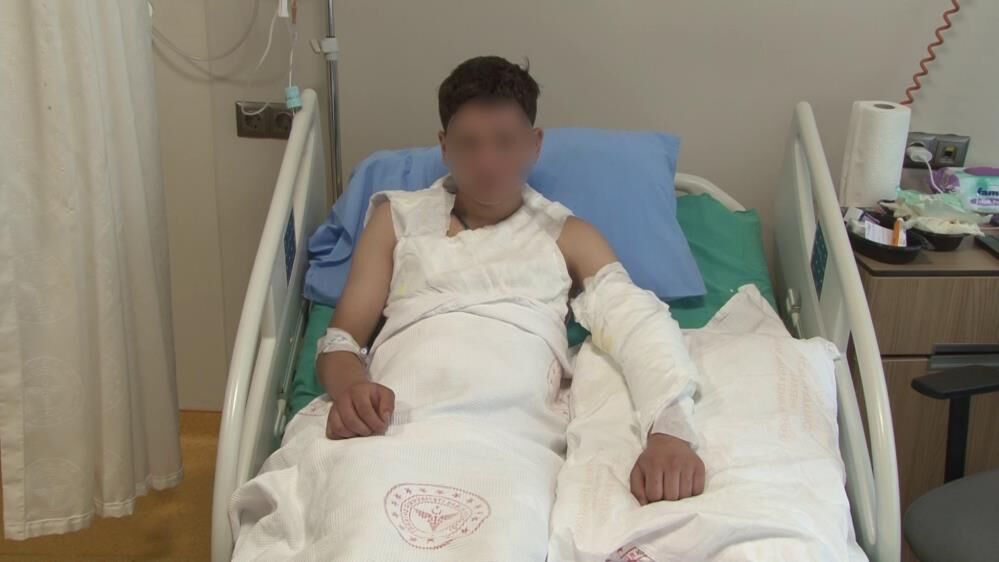 Kolonya Dokup Cakmagi Cakinca Olumden Dondu 15 Yasindaki Cocugun Vucudunun Yuzde 25I Y (5)