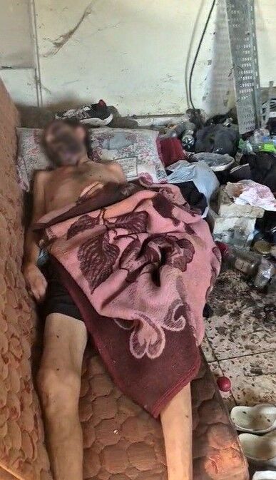 Darp Edildi Metruk Eve Terk Edildi Gunlerce Coplerin Arasinda Yasam Savasi Verdi (2)