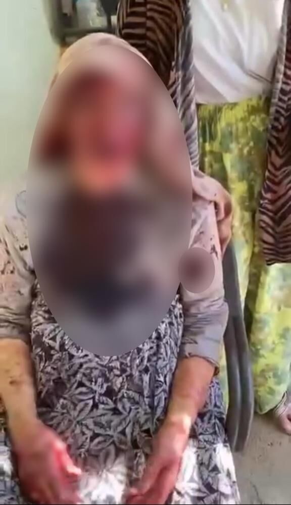 Dehset Anlari Kamerada 85 Yasindaki Annesini Olduresiye Dovdu (3)