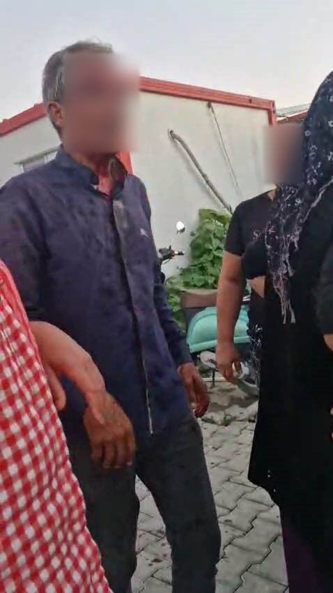 Elinde Palayla Dehşet Saçtı! Eşini, Kızlarını Ve Bacanağını Yaraladı (3)